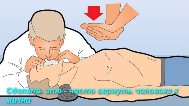 врач делает искусственное дыхание